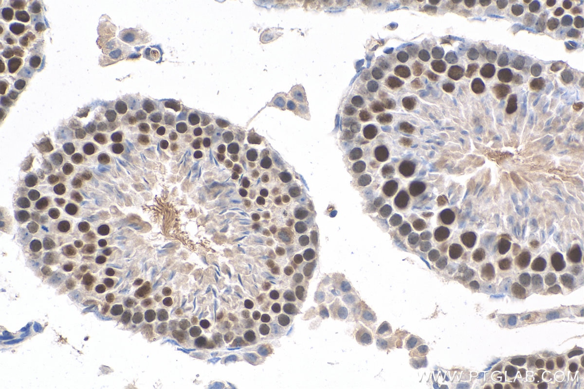 Immunohistochemistry (IHC) staining of mouse testis tissue using ID4 Polyclonal antibody (21803-1-AP)