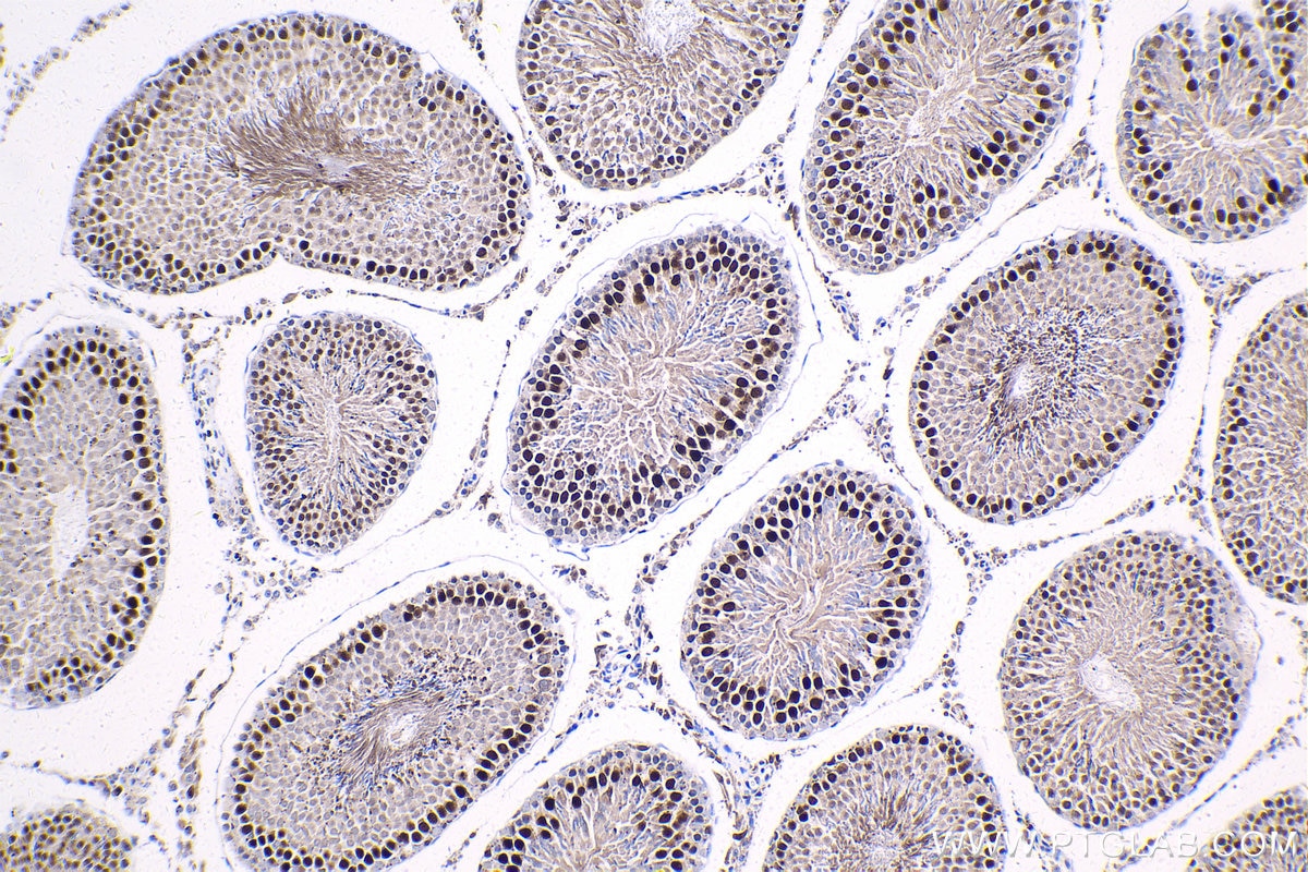 Immunohistochemistry (IHC) staining of rat testis tissue using ID4 Polyclonal antibody (21803-1-AP)