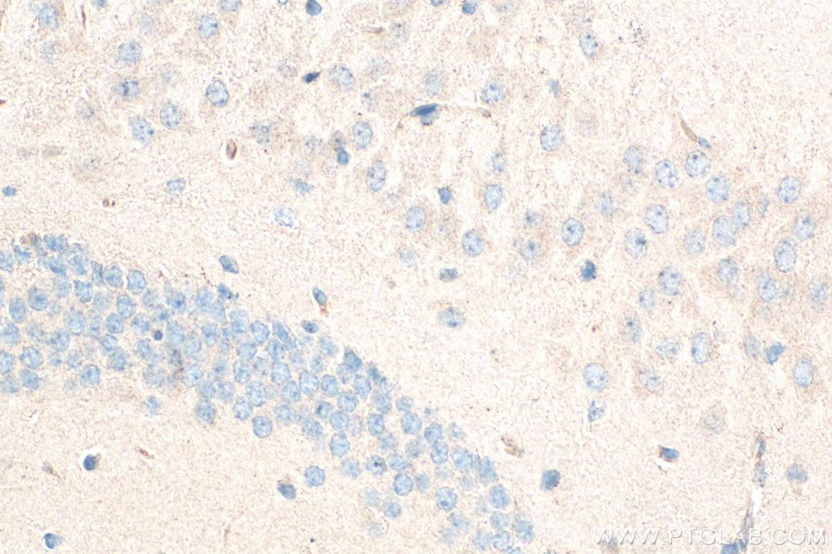 Immunohistochemical analysis of paraffin-embedded mouse brain tissue slide using 21728-1-AP (IDE antibody) at dilution of 1:200 (under 40x lens). Heat mediated antigen retrieval with Tris-EDTA buffer (pH 9.0). Immunohistochemistry (IHC) staining of mouse brain tissue using IDE Polyclonal antibody (21728-1-AP)