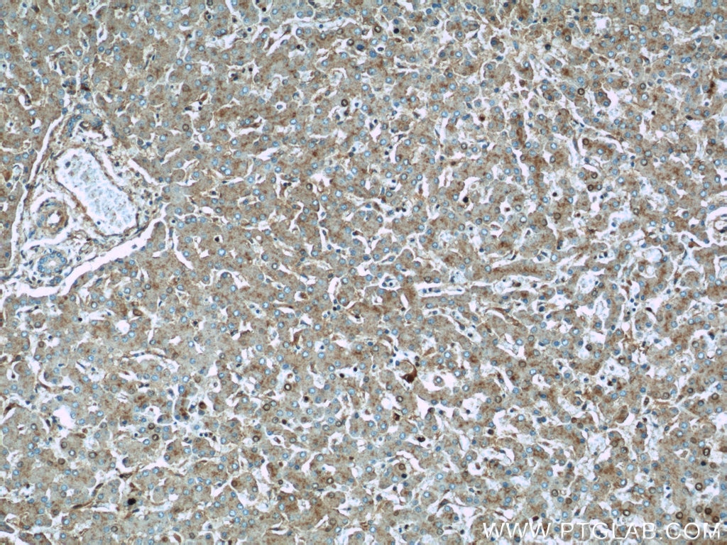 IHC staining of human liver using 21728-1-AP