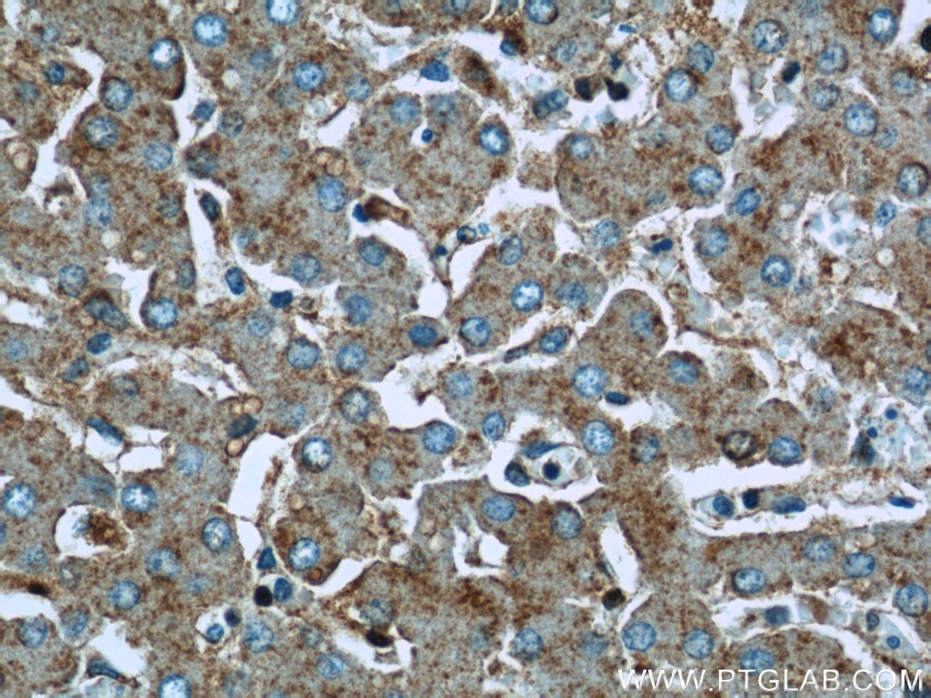 Immunohistochemistry (IHC) staining of human liver tissue using IDE Polyclonal antibody (21728-1-AP)