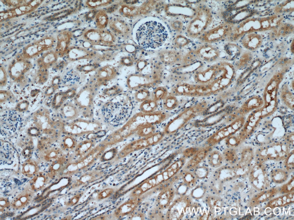 Immunohistochemistry (IHC) staining of human kidney tissue using IDE Polyclonal antibody (21728-1-AP)
