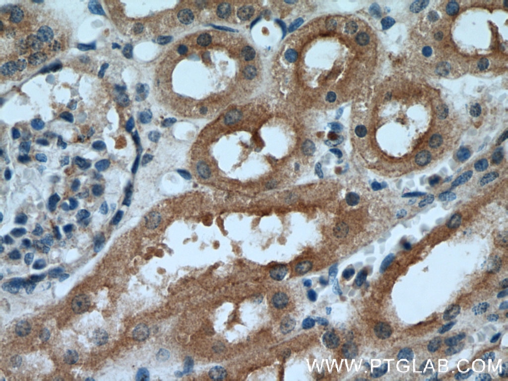 Immunohistochemistry (IHC) staining of human kidney tissue using IDE Polyclonal antibody (21728-1-AP)