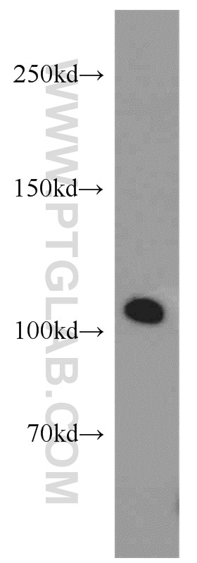 Western Blot (WB) analysis of A2780 cells using IDE Polyclonal antibody (21728-1-AP)