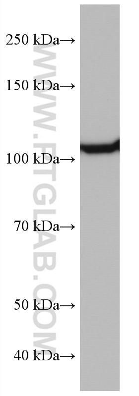 WB analysis of Jurkat using 67106-1-Ig
