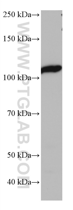 WB analysis of RAW 264.7 using 67106-1-Ig