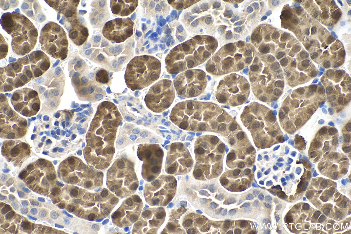 IHC staining of mouse kidney using 23309-1-AP