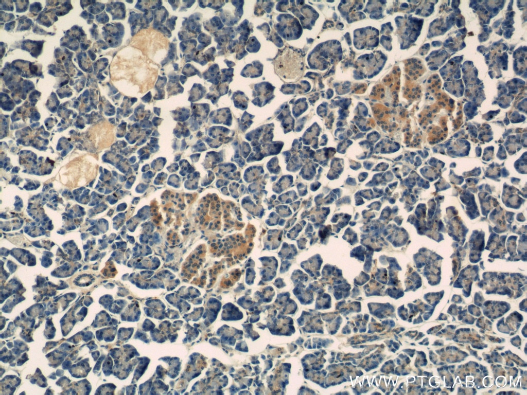 Immunohistochemistry (IHC) staining of human pancreas tissue using IDH1 Monoclonal antibody (66197-1-Ig)