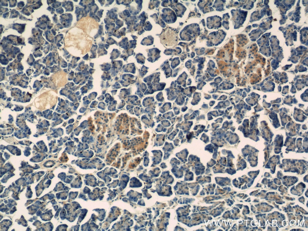 IHC staining of human pancreas using 66197-1-Ig