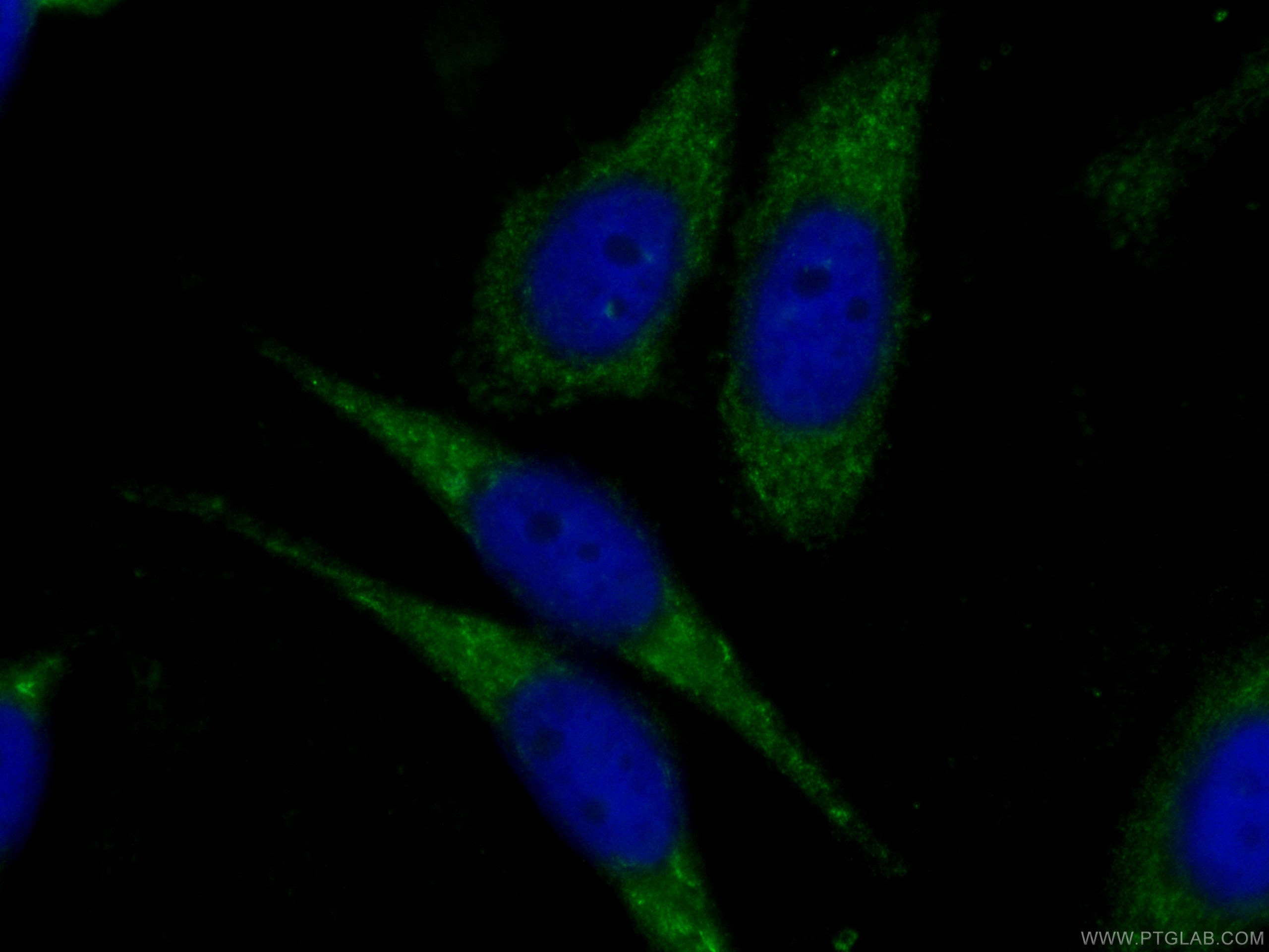 IF Staining of HepG2 using CL488-66197