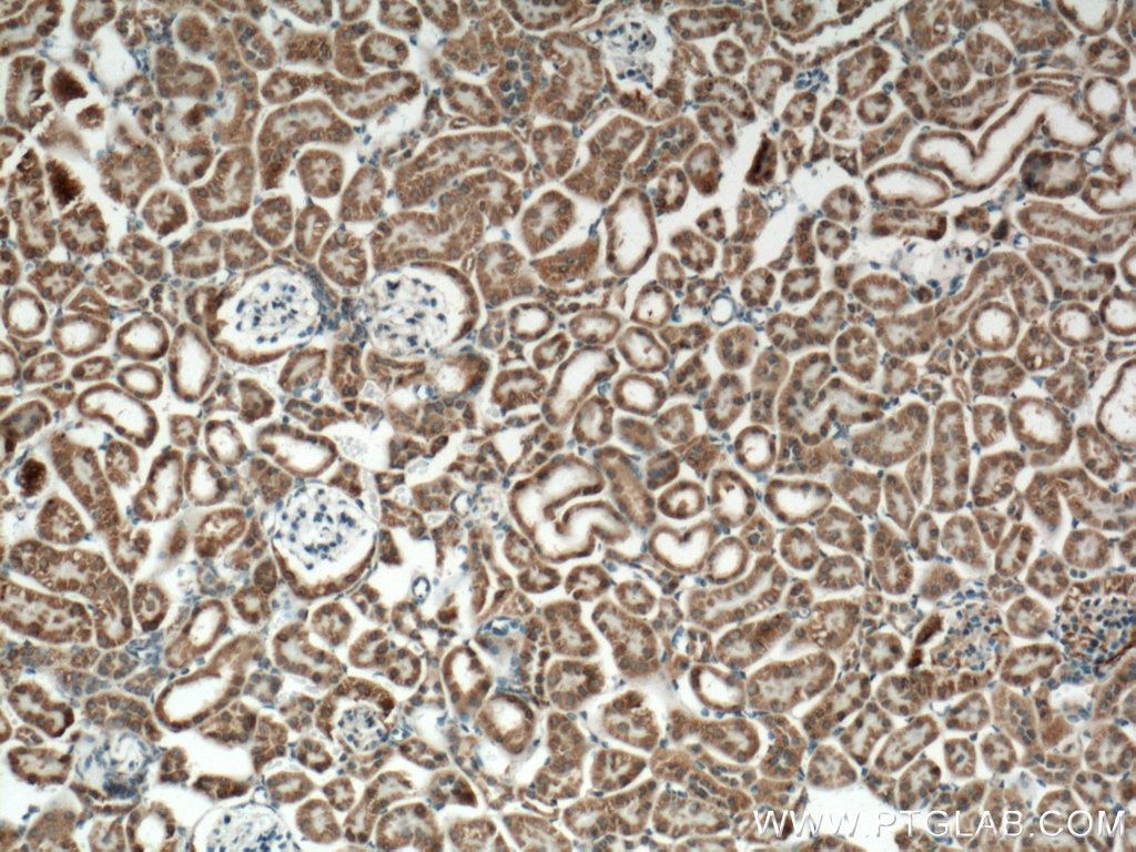 Immunohistochemistry (IHC) staining of mouse kidney tissue using IDH2 Polyclonal antibody (15932-1-AP)