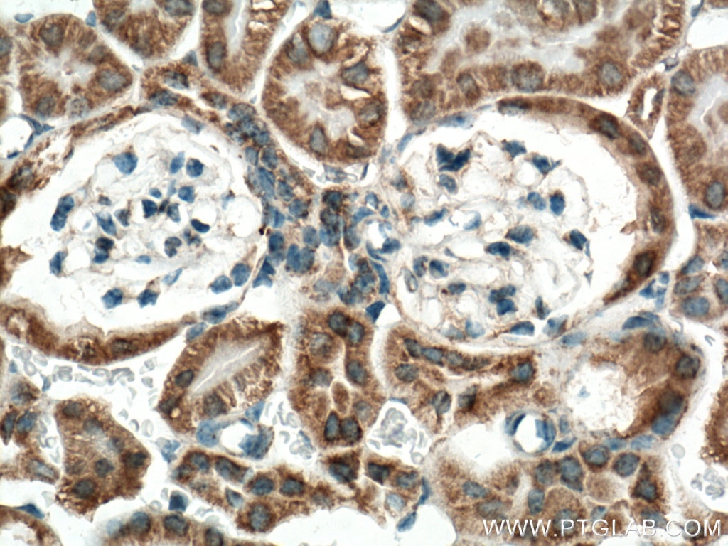 Immunohistochemistry (IHC) staining of mouse kidney tissue using IDH2 Polyclonal antibody (15932-1-AP)