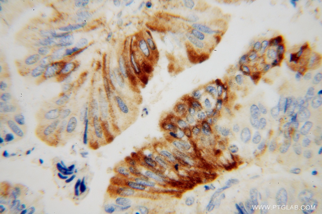 IDH2 Polyclonal antibody