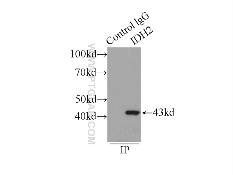 IP experiment of mouse brain using 15932-1-AP