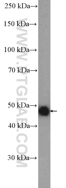Western Blot (WB) analysis of Jurkat cells using IDH2 Polyclonal antibody (15932-1-AP)