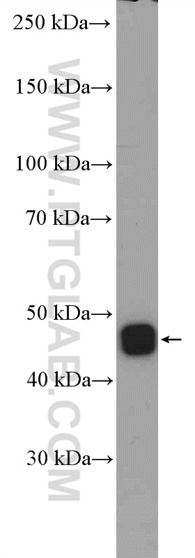 Western Blot (WB) analysis of Jurkat cells using IDH2 Polyclonal antibody (15932-1-AP)