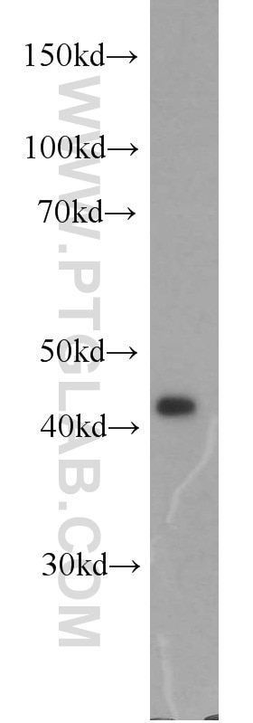 Western Blot (WB) analysis of HeLa cells using IDH2 Polyclonal antibody (15932-1-AP)