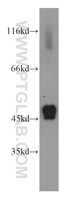 Western Blot (WB) analysis of mouse heart tissue using IDH2 Polyclonal antibody (15932-1-AP)