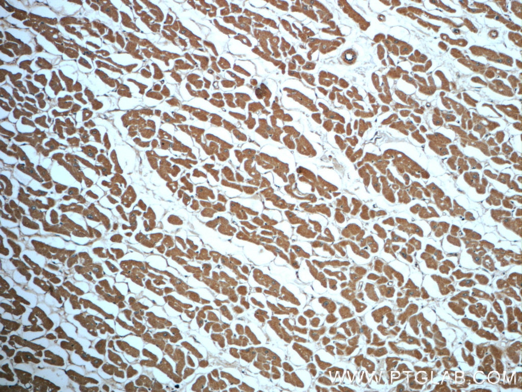 Immunohistochemistry (IHC) staining of human heart tissue using IDH2 Polyclonal antibody (23254-1-AP)