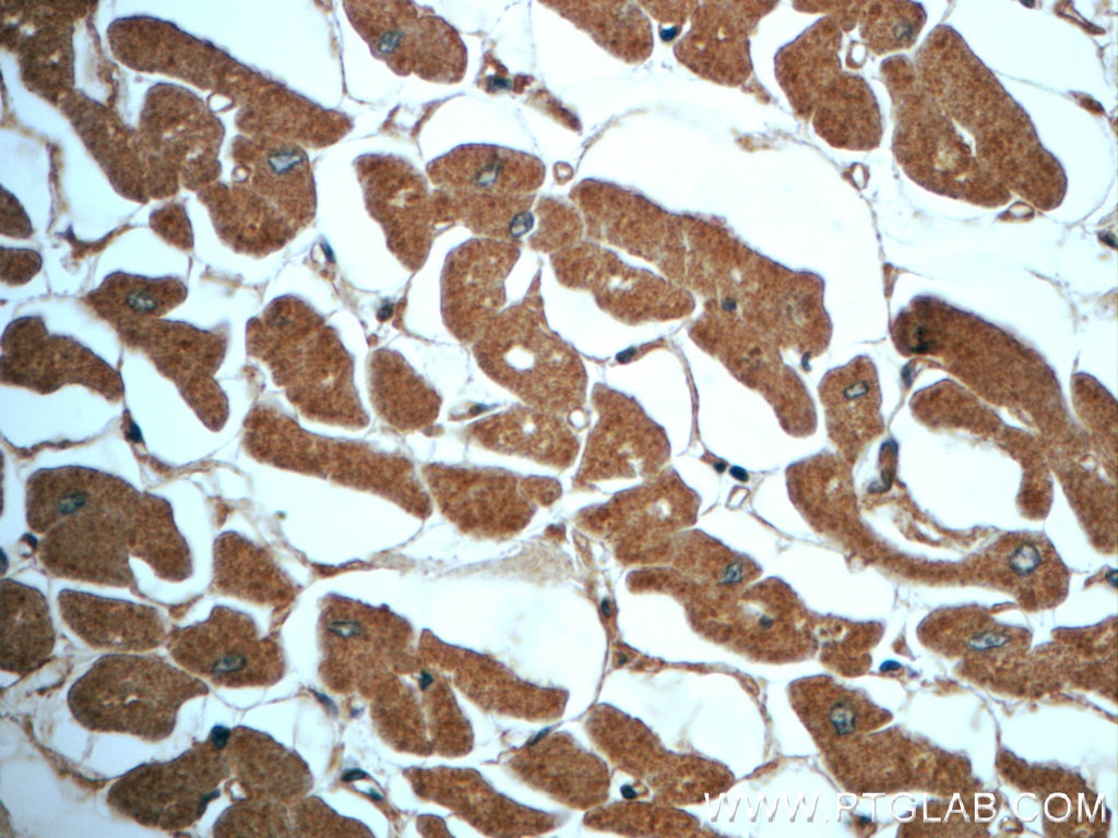 Immunohistochemistry (IHC) staining of human heart tissue using IDH2 Polyclonal antibody (23254-1-AP)