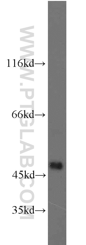 Western Blot (WB) analysis of DU 145 cells using IDH2 Polyclonal antibody (23254-1-AP)