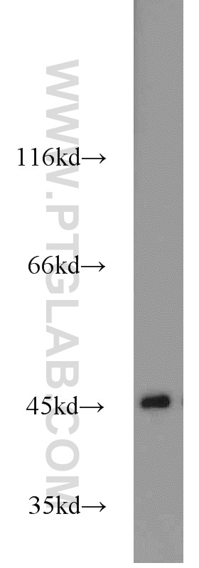 Western Blot (WB) analysis of Jurkat cells using IDH2 Polyclonal antibody (23254-1-AP)