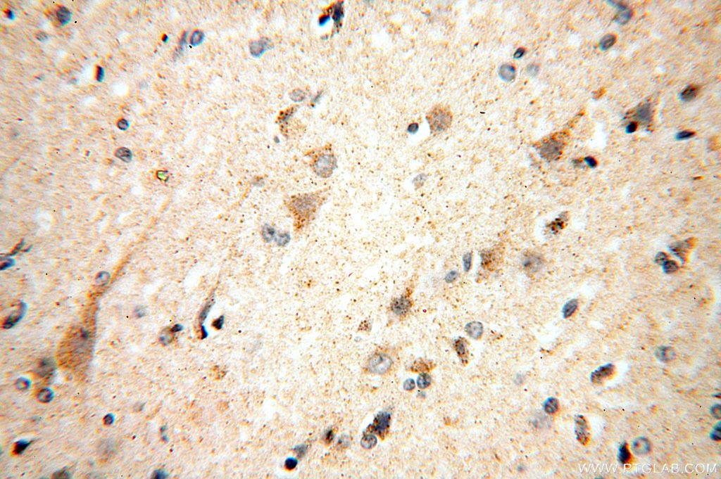 Immunohistochemistry (IHC) staining of human brain tissue using IDH3A Polyclonal antibody (15909-1-AP)