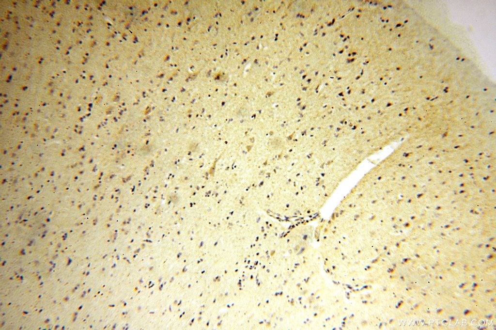 Immunohistochemistry (IHC) staining of human brain tissue using IDH3A Polyclonal antibody (15909-1-AP)