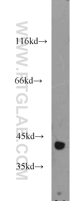 Western Blot (WB) analysis of human skeletal muscle tissue using IDH3A Polyclonal antibody (15909-1-AP)