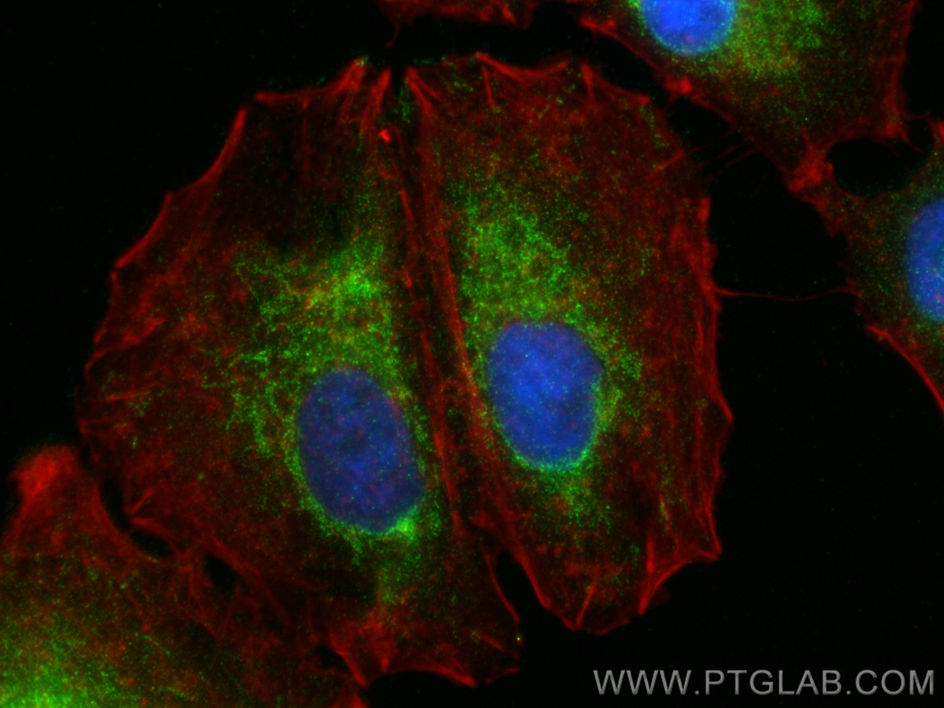Immunofluorescence (IF) / fluorescent staining of A549 cells using IDH3B Polyclonal antibody (15576-1-AP)