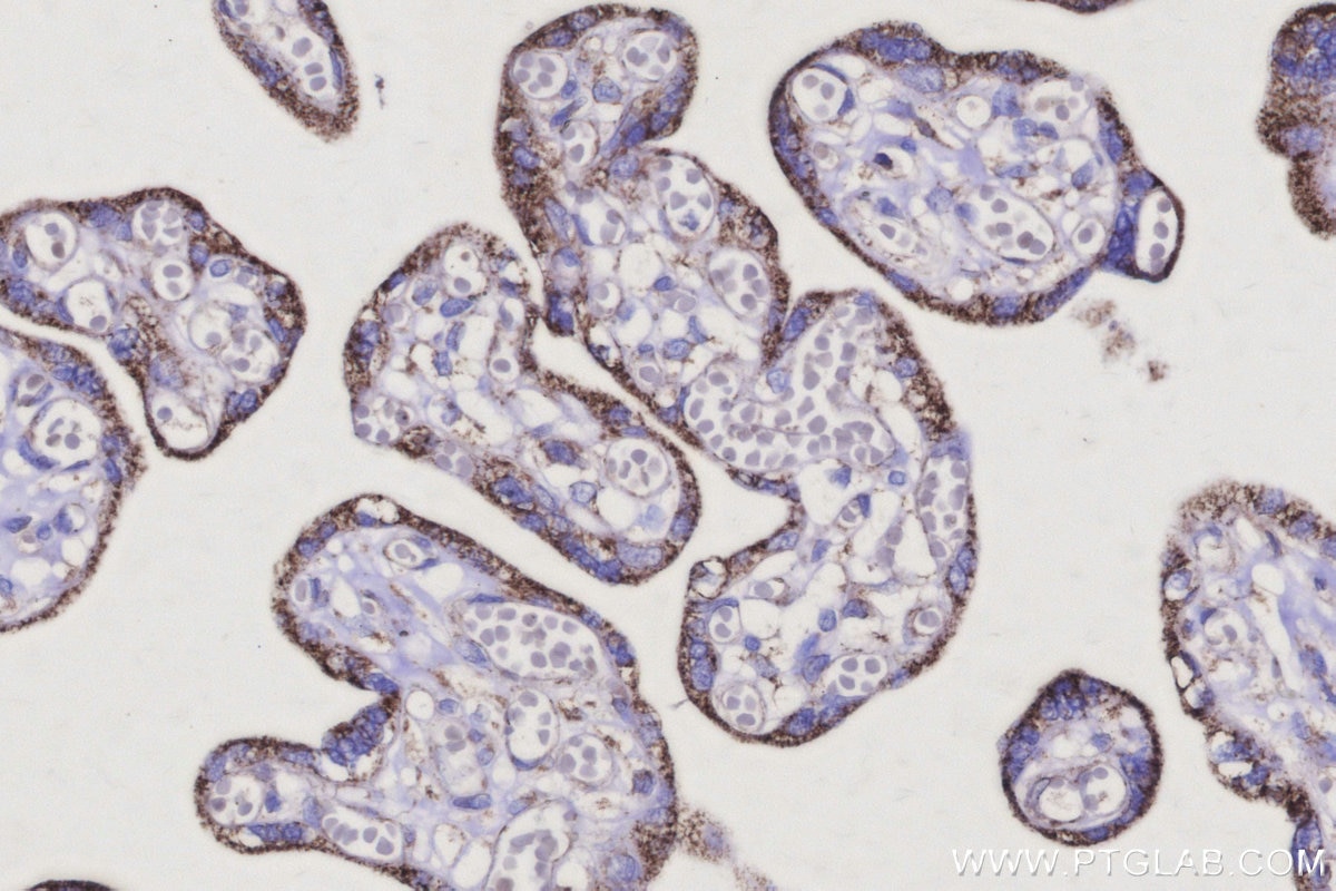 IHC staining of human placenta using 68199-1-Ig Immunohistochemistry (IHC) staining of human placenta tissue using IDH3B Monoclonal antibody (68199-1-Ig)