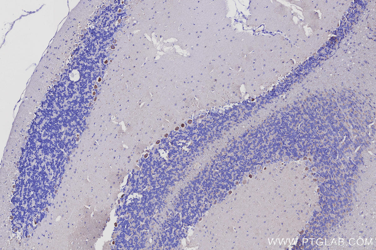 IHC staining of rat cerebellum using 68199-1-Ig Immunohistochemistry (IHC) staining of rat cerebellum tissue using IDH3B Monoclonal antibody (68199-1-Ig)