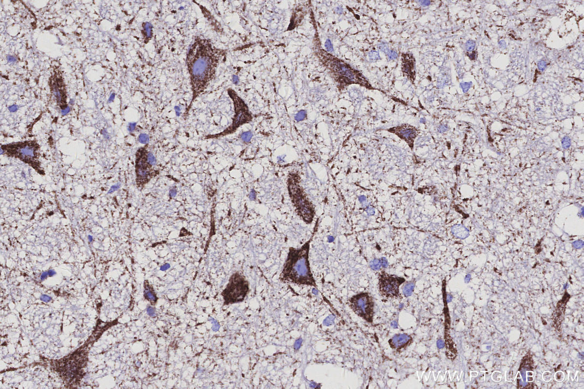 IHC staining of mouse cerebellum using 68199-1-Ig Immunohistochemistry (IHC) staining of mouse cerebellum tissue using IDH3B Monoclonal antibody (68199-1-Ig)
