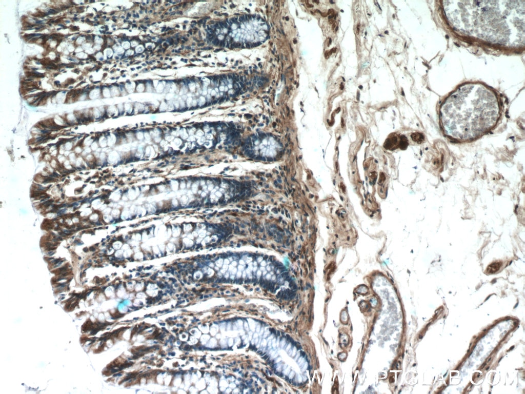 IHC staining of human colon using 25848-1-AP