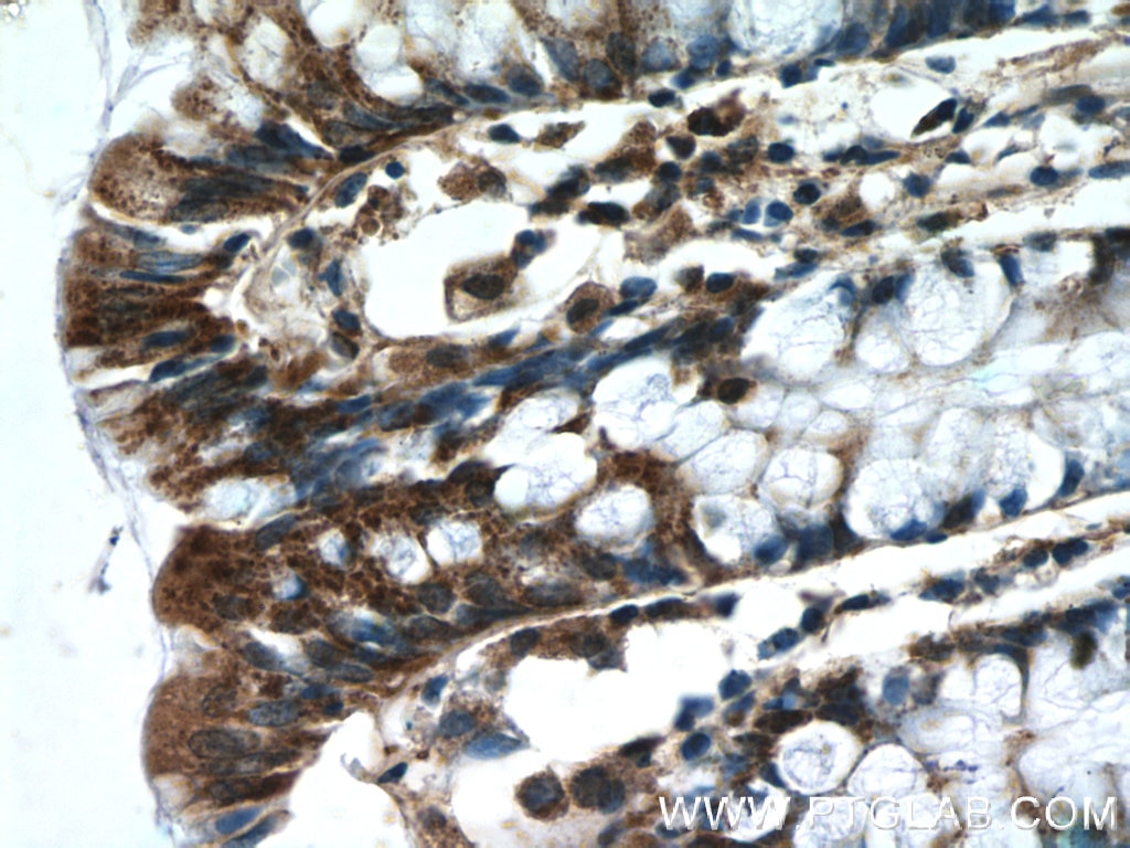 IHC staining of human colon using 25848-1-AP