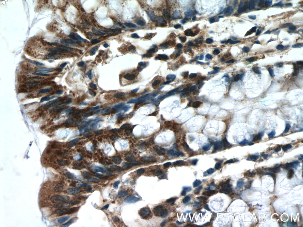 Immunohistochemistry (IHC) staining of human colon tissue using IDH3G Polyclonal antibody (25848-1-AP)