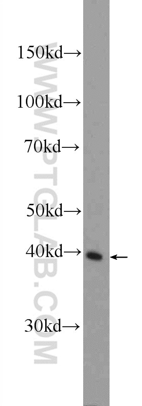 Western Blot (WB) analysis of A375 cells using IDH3G Polyclonal antibody (25848-1-AP)