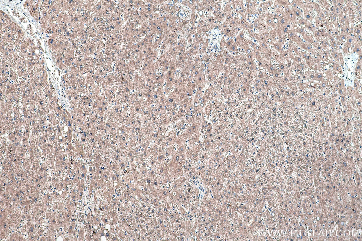Immunohistochemistry (IHC) staining of human liver tissue using IDI1 Polyclonal antibody (11166-2-AP)