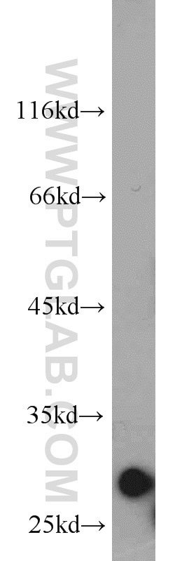 WB analysis of L02 using 11166-2-AP