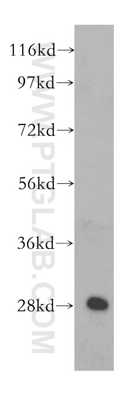 WB analysis of human liver using 11166-2-AP