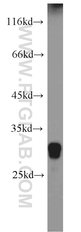 Western Blot (WB) analysis of human skeletal muscle tissue using IDI2 Polyclonal antibody (16701-1-AP)