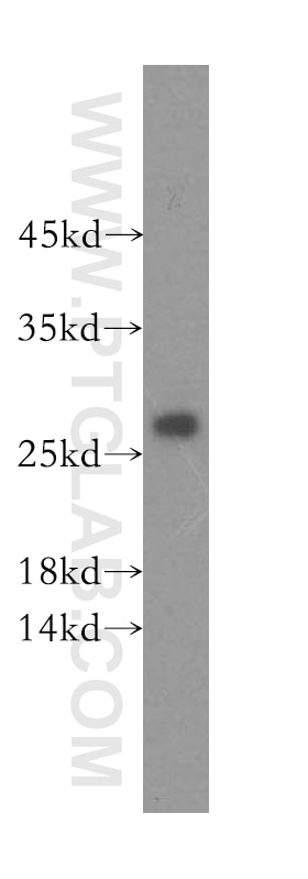 Western Blot (WB) analysis of human skeletal muscle tissue using IDI2 Polyclonal antibody (16701-1-AP)