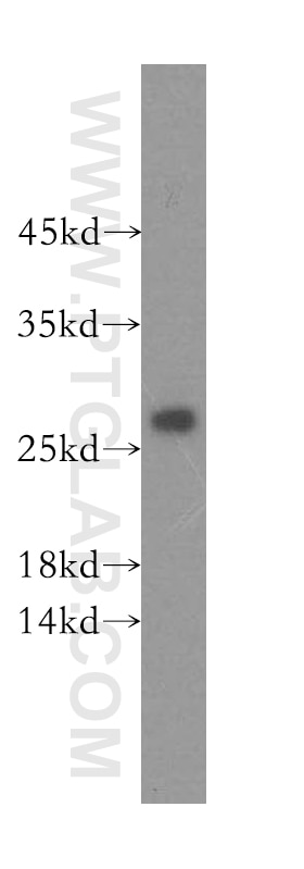 WB analysis of human skeletal muscle using 16701-1-AP