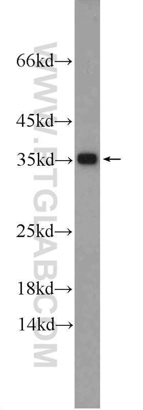 Western Blot (WB) analysis of HEK-293 cells using IDNK Polyclonal antibody (24831-1-AP)