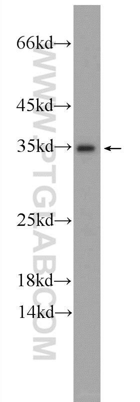 Western Blot (WB) analysis of human testis tissue using IDNK Polyclonal antibody (24831-1-AP)
