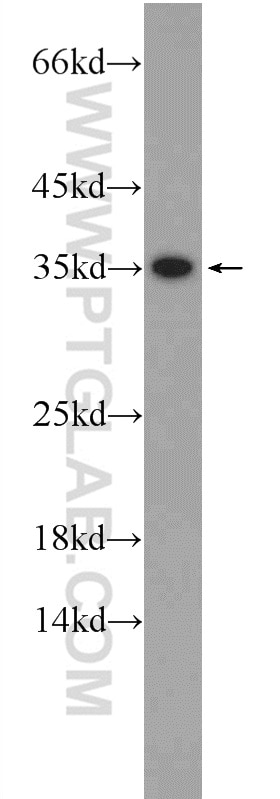 Western Blot (WB) analysis of HeLa cells using IDNK Polyclonal antibody (24831-1-AP)