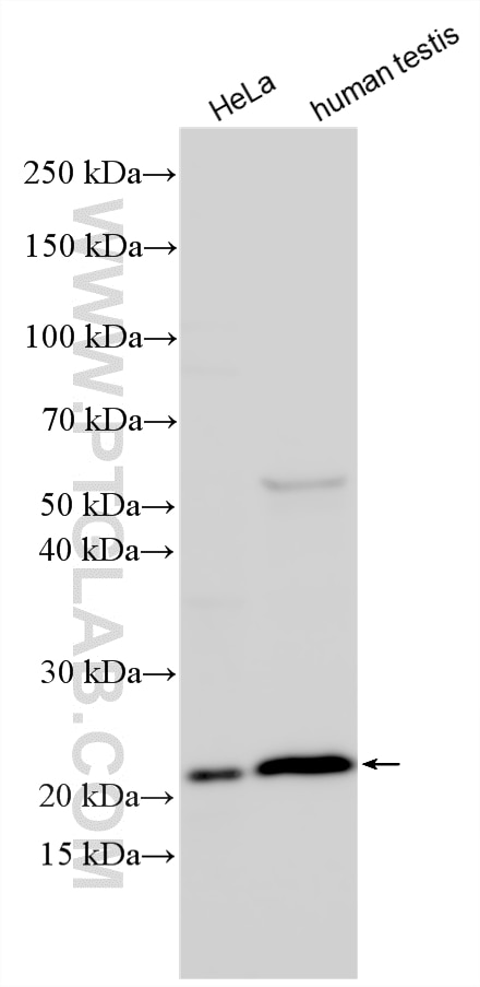Western Blot (WB) analysis of various lysates using IDNK Polyclonal antibody (24831-1-AP)
