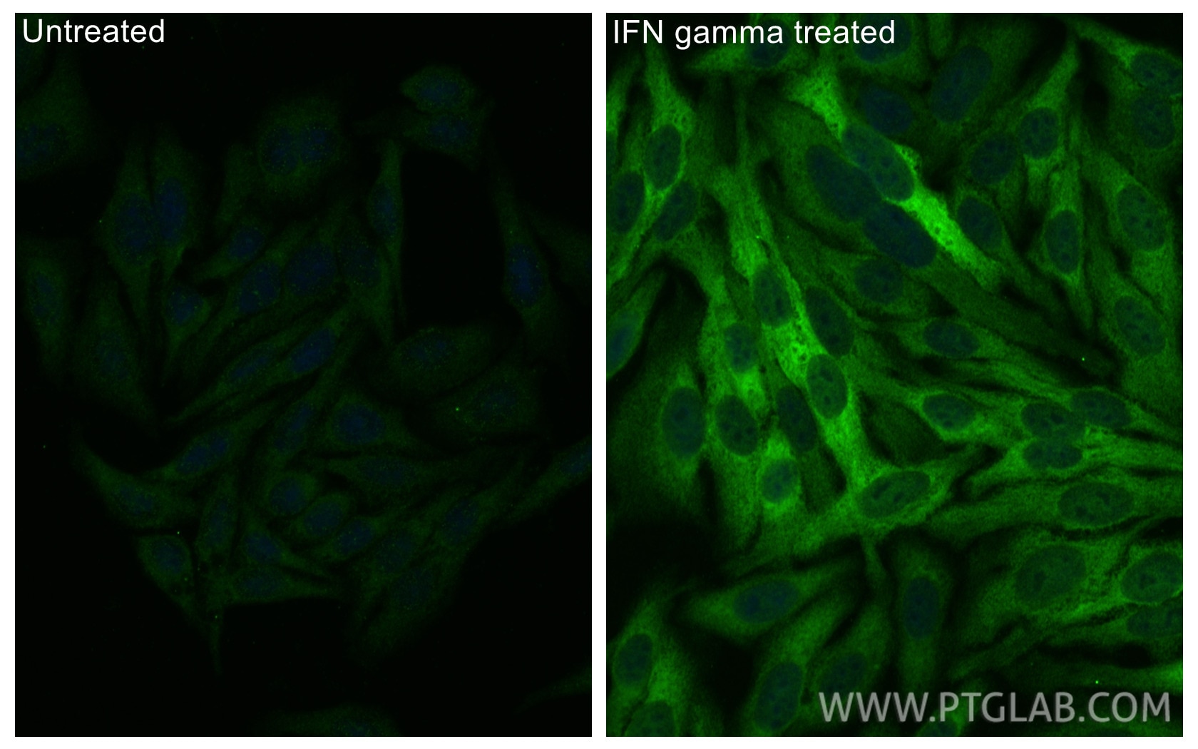IF Staining of HepG2 using 13268-1-AP Immunofluorescence (IF) / fluorescent staining of HepG2 cells using IDO1 Polyclonal antibody (13268-1-AP)