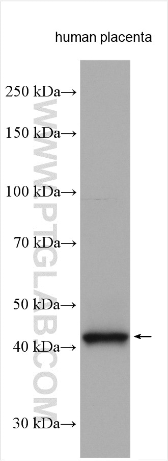 Western Blot (WB) analysis of various lysates using IDO1 Polyclonal antibody (13268-1-AP)