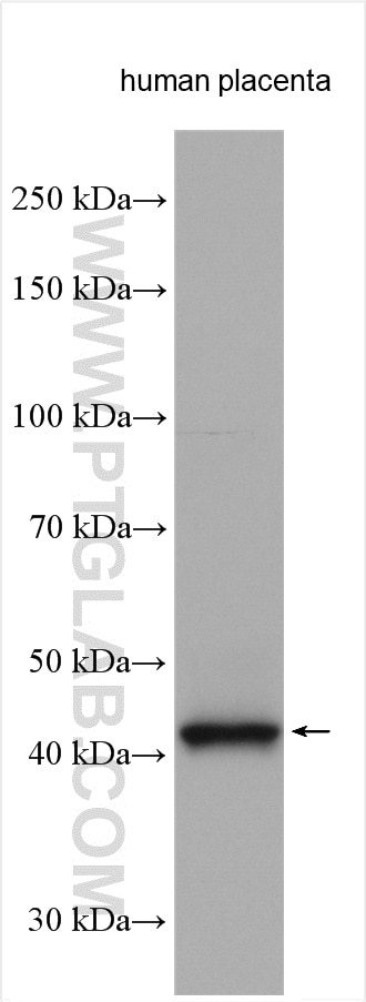 WB analysis using 13268-1-AP